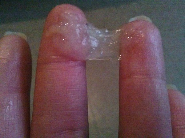 Фото: прозрачая слизь как сопли из матки на пальцах